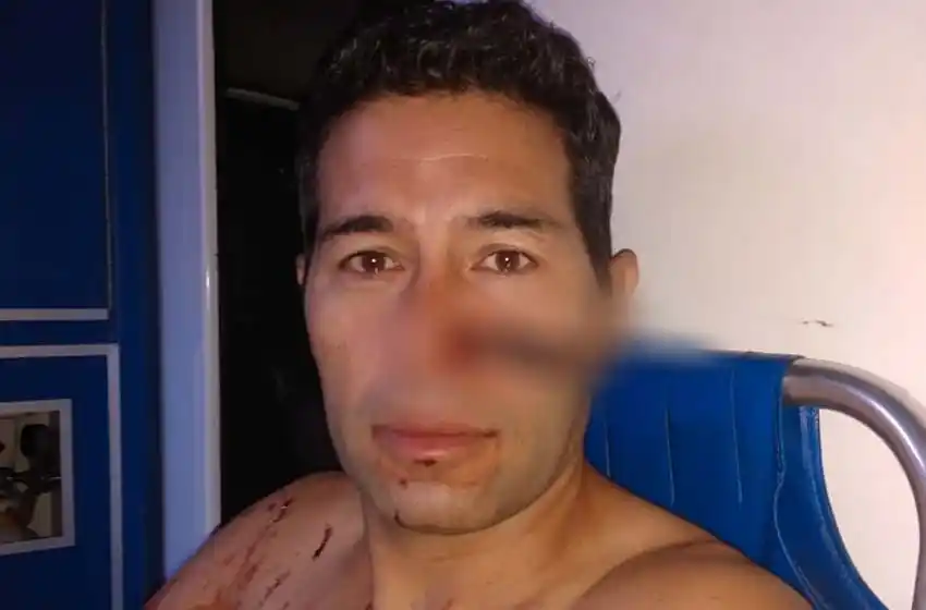 Violento: le clavó un cuchillo en la nariz a la actual pareja de su ex novia y terminó detenido