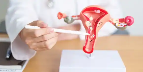 Día Internacional de la Endometriosis, una enfermedad que afecta aproximadamente al 10% de las mujeres