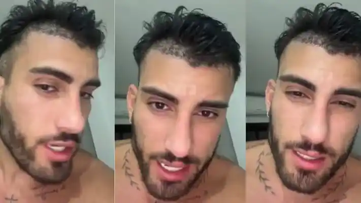 Tomás Holder mostró su implante capilar: “Tenía entradas y quería cambiarlo”