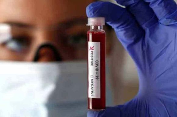 Coronavirus en Argentina: confirmaron 29 nuevos fallecidos y la cifra de víctimas fatales asciende a 2.617
