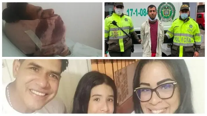 A PUÑALADAS casi matan a venezolano en Bogotá: lo hirieron en un acto de xenofobia