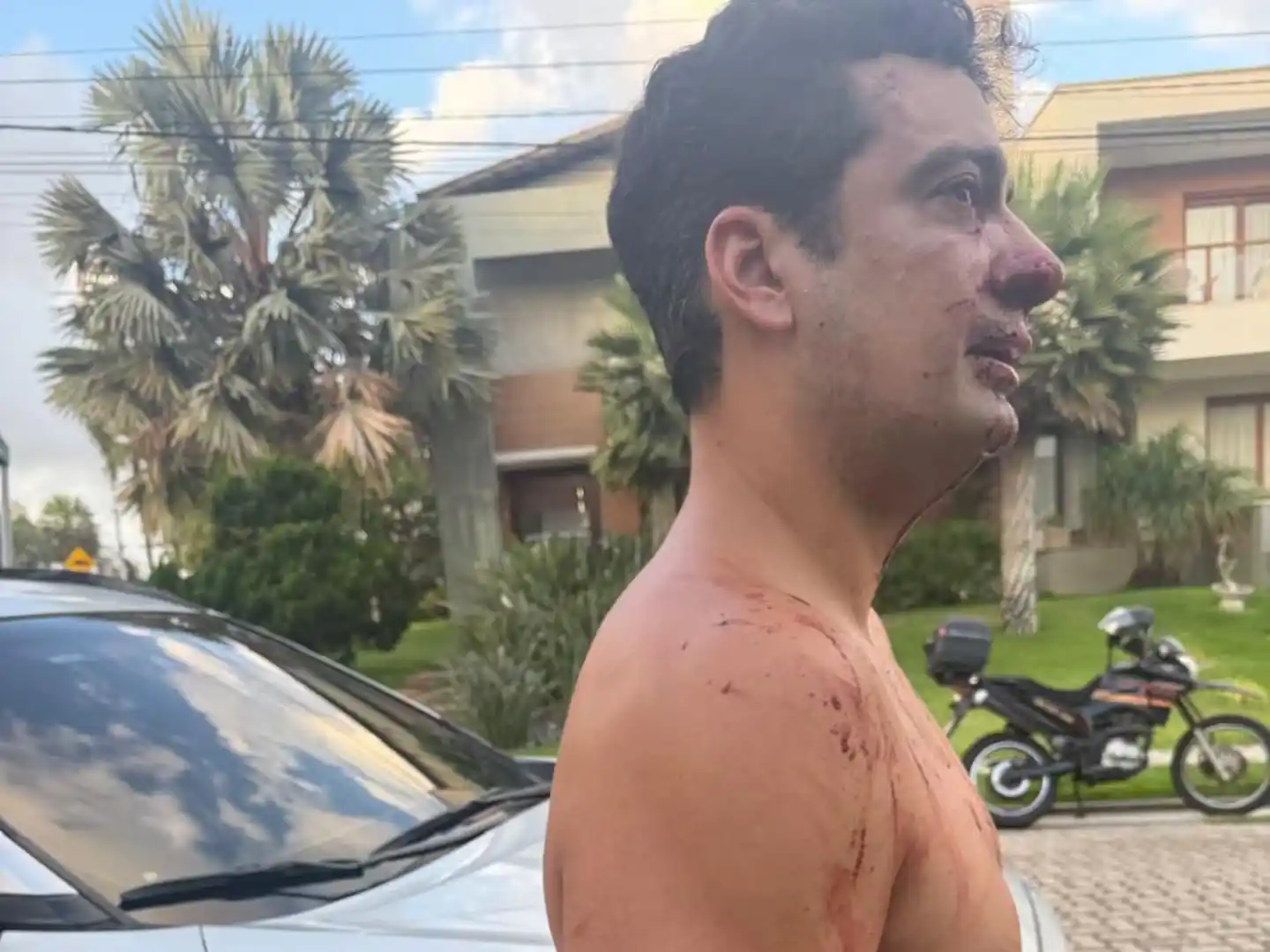 vecino brasileño de Eros Mancuso