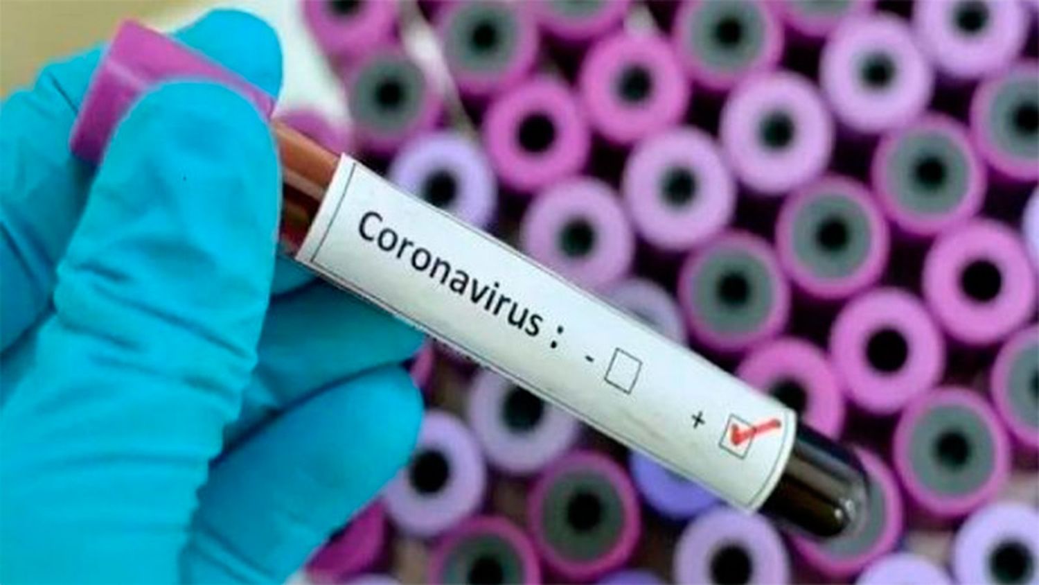 Argentina se encuentra en alerta epidemiológico por el coronavirus