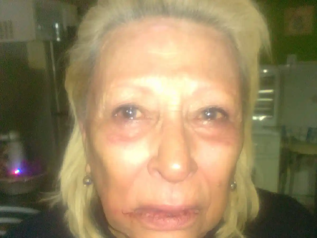 Estremecedor relato del nieto de la mujer violentamente asaltada en Arroyito 