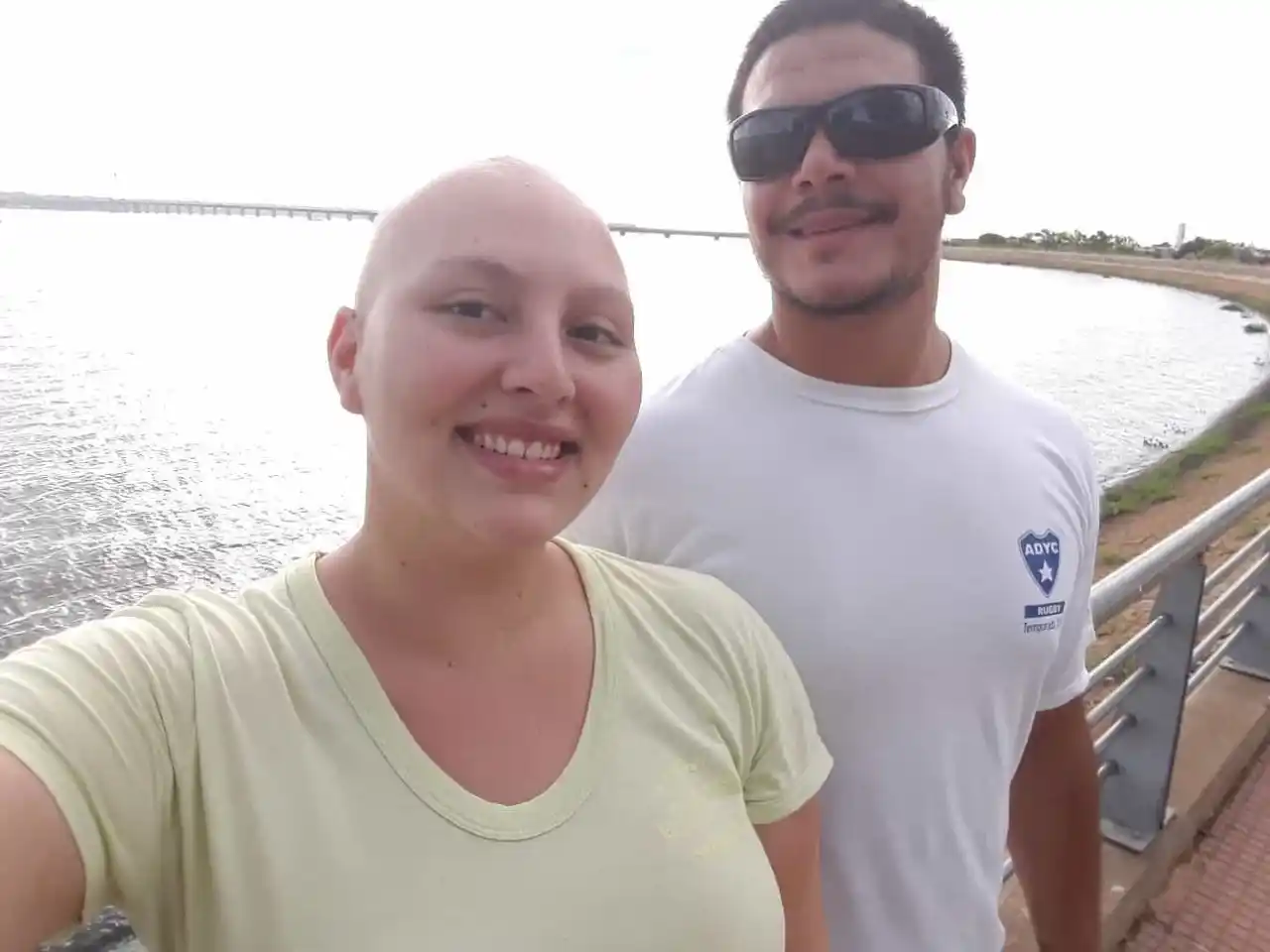 ¿Sabes que es la Alopecia?, Nadia te lo cuenta en primera persona