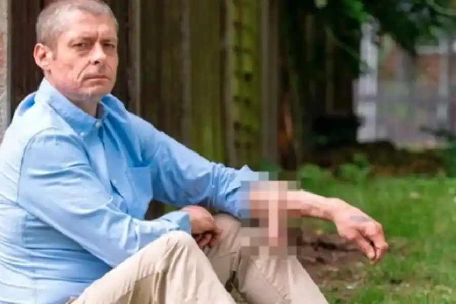 Vivió 6 años con un injerto de pene en el brazo y después de una larga espera se lo ubicaron en el lugar correcto