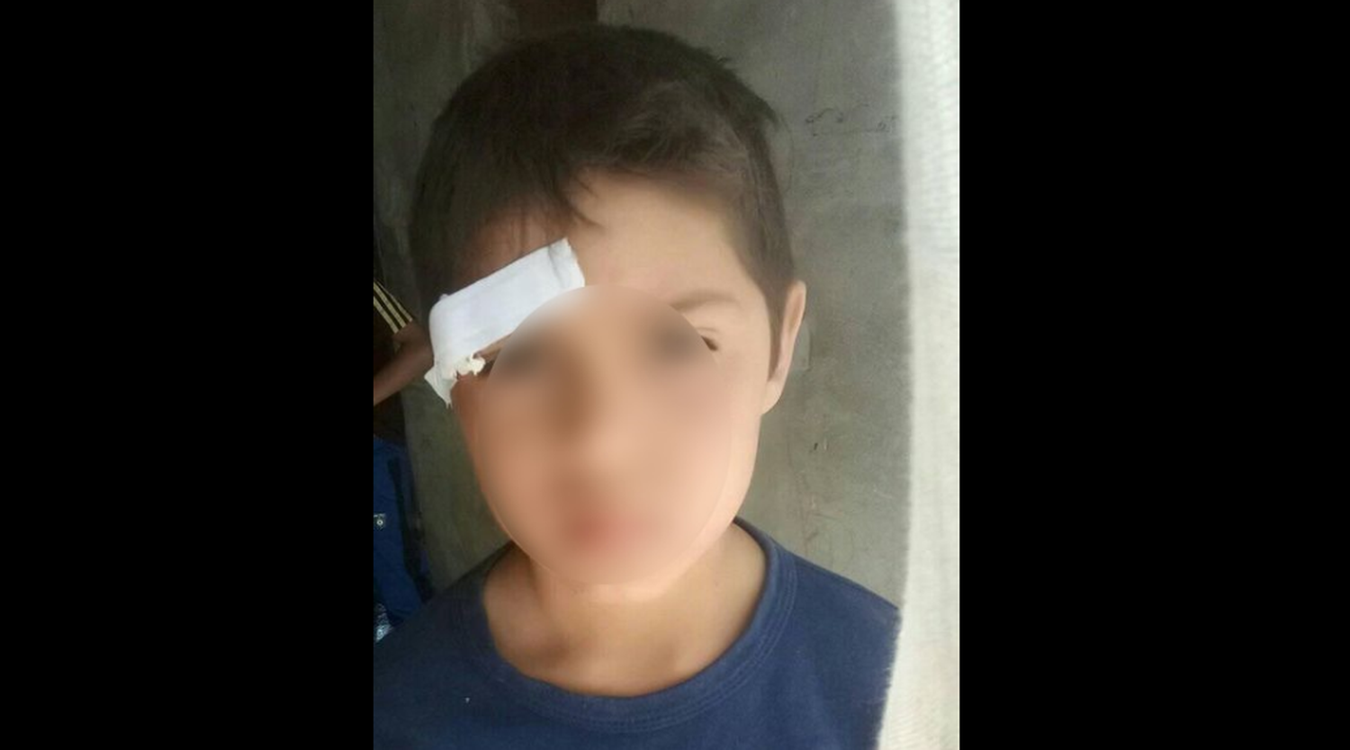 Hermano Indio: “Lastimaron a mi hijo con una bala de goma”