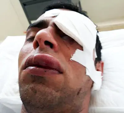 Lo hirieron con una botella en el rostro y lucha por su vida