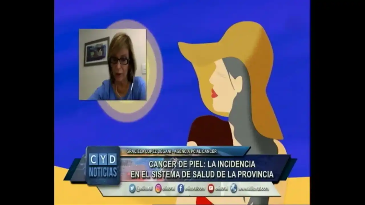 Hasta el 19 se realizan controles sin turno para prevenir el Cáncer de Piel