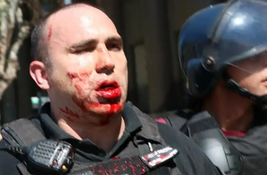 Macri, Larreta y Bullrich visitaron a los policías heridos durante los incidentes