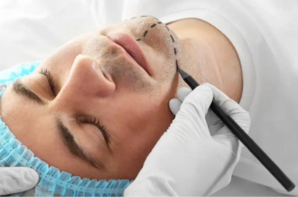 La Justicia ordenó a una prepaga cubrir la totalidad de una cirugía de feminización facial