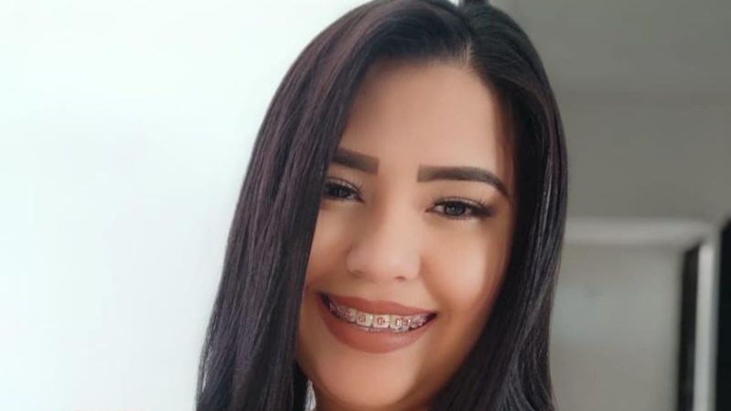 Aparatoso accidente acaba con la vida de una migrante venezolana en República Dominicana