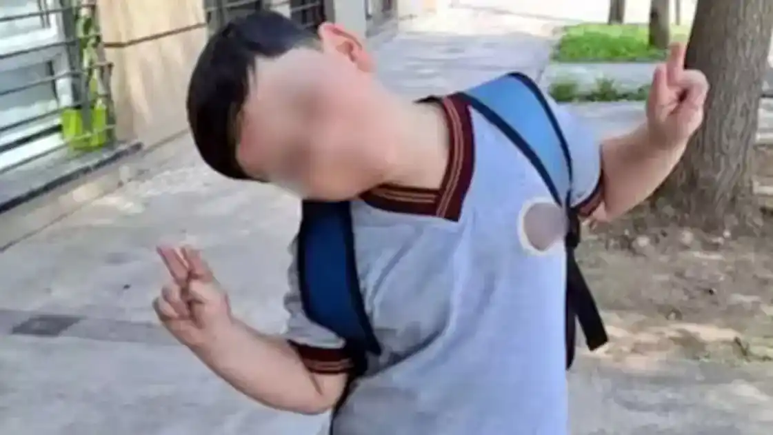 Bastián fue operado por sexta vez y se le realizó una traqueotomía