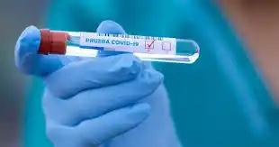 Coronavirus: murió un hombre de 76 años y es la víctima fatal 67 de la pandemia, la sexta del año