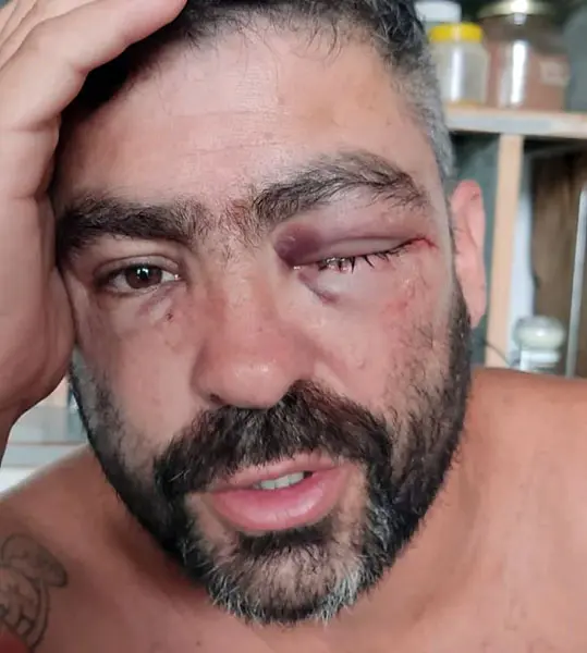 Ataque y robo “piraña” a un músico que terminó herido