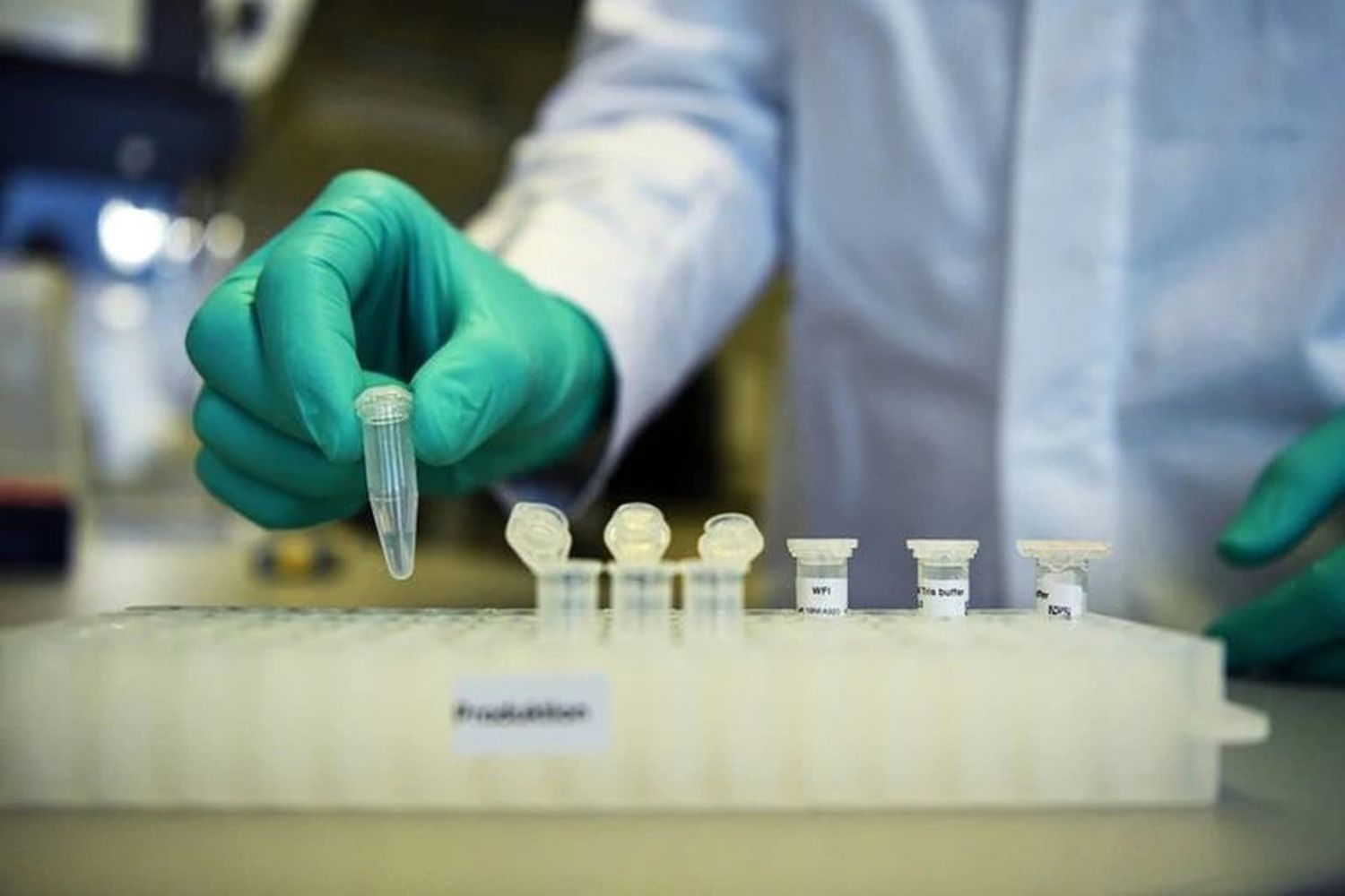Un sensor de ADN puede detectar cuando una persona con coronavirus es más contagiosa