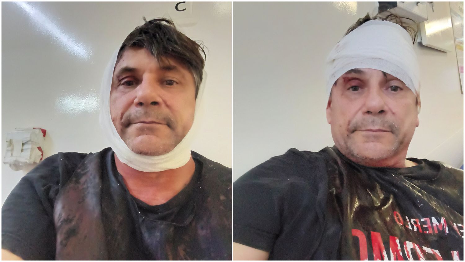 Denuncian que le dieron un culatazo en la cabeza a un candidato a concejal mientras pegaba afiches en Merlo