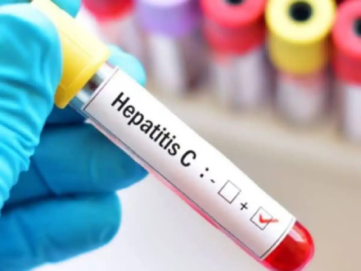Hepatitis C: especialistas piden que todos los pacientes puedan acceder a la medicación para curarla