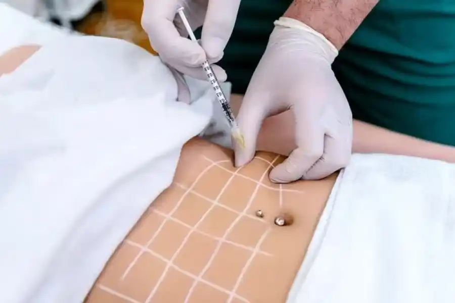 Crece la cantidad de uruguayos que viaja a Argentina a hacerse cirugías estéticas