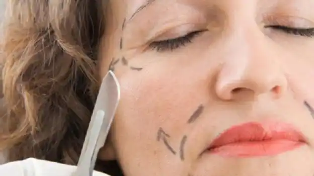 Polémica por el sorteo de cirugías estéticas en un boliche correntino