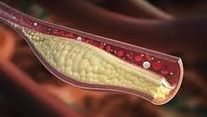 Estos son los 12 mejores alimentos para DESTAPAR LAS ARTERIAS