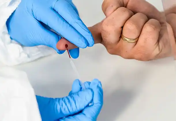 Confirman otros 117 muertos y se suman 9.924 contagios de coronavirus