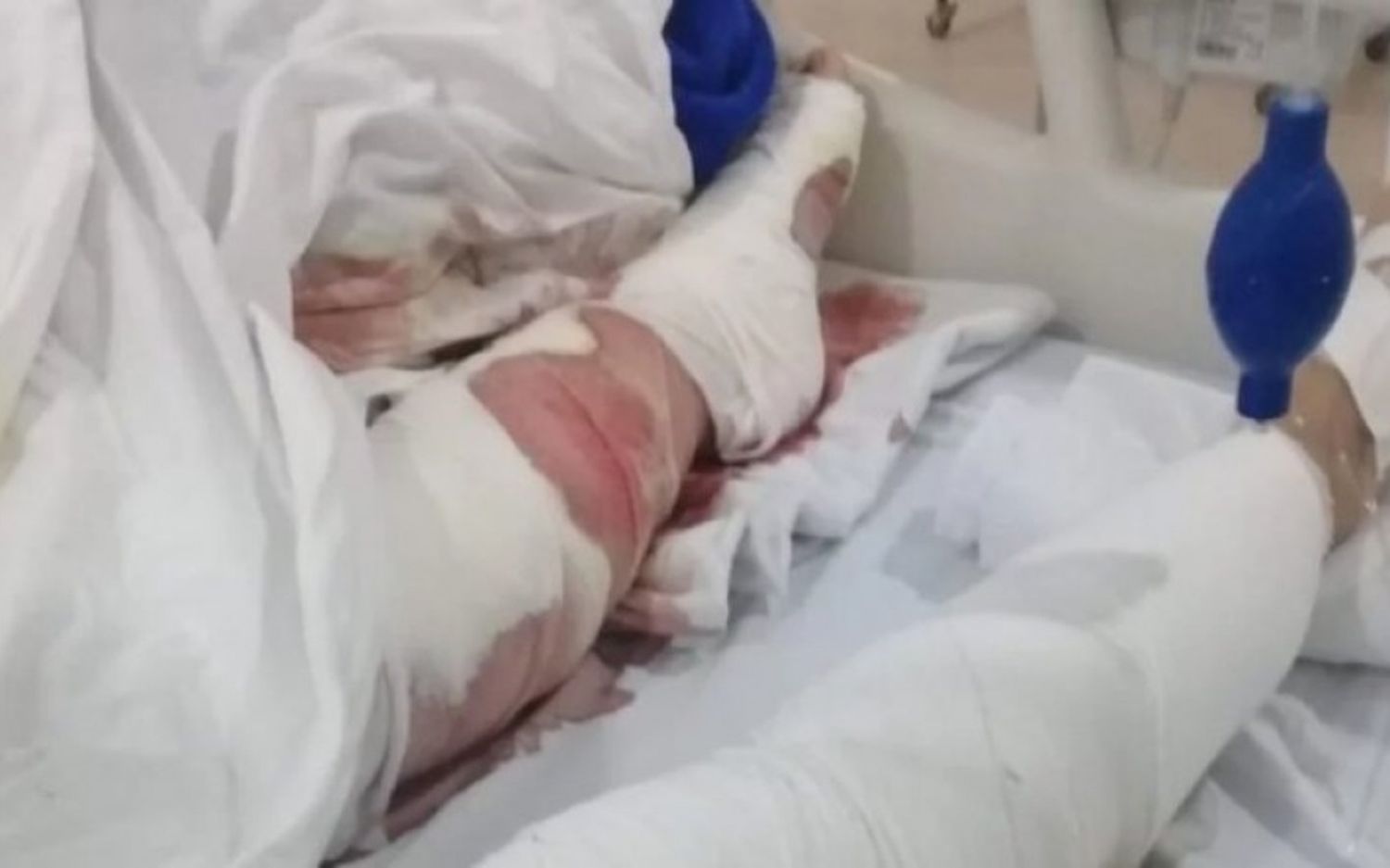 Mar del Plata: Una mujer salió a caminar a la playa y fue brutalmente atacada por tres perros