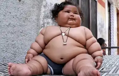 La historia de la bebé de 8 meses que pesa 17 kilos