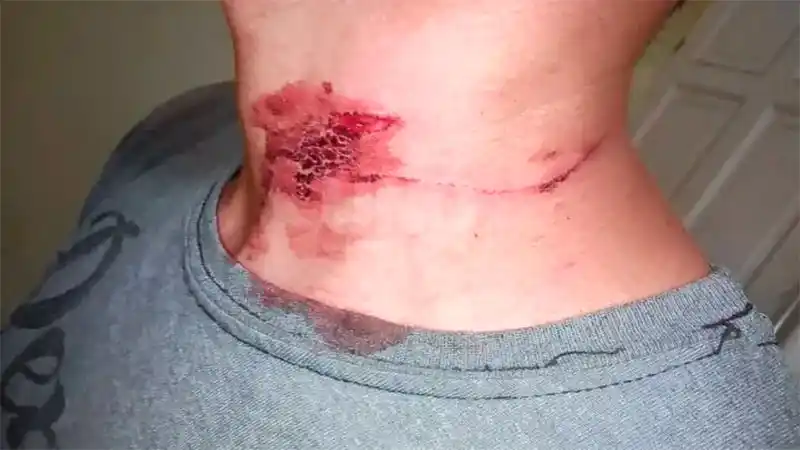 Pareja abordó a un joven que esperaba el colectivo y le cortaron el cuello para robarle