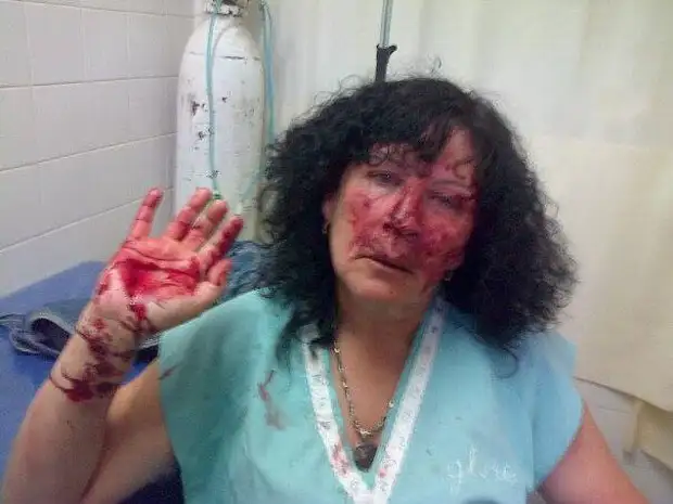 Una mujer fue abordada por otra en la calle, que le dio una feroz golpiza