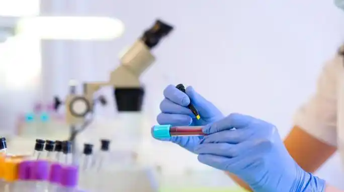 Se registraron 128 nuevos casos de coronavirus en el país