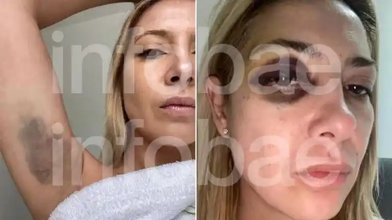 Las fotos de Fabiola Yañez que están en la causa judicial