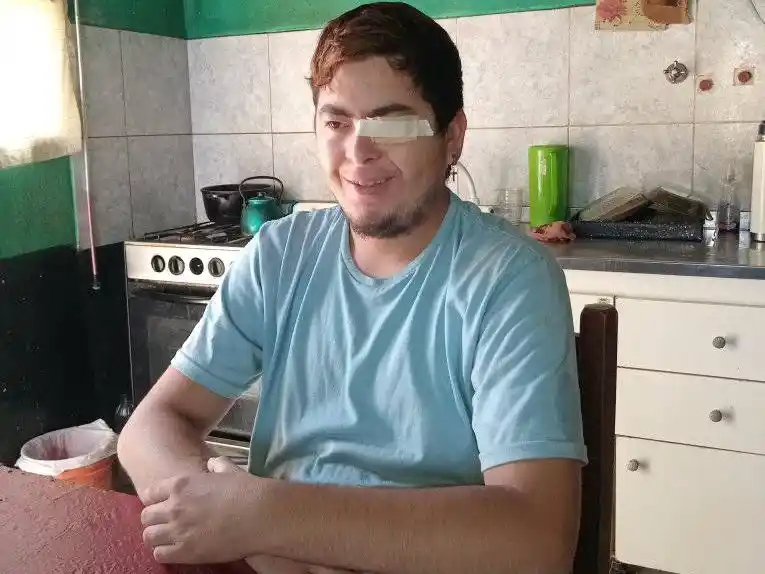 Lucas necesita ayuda para costear su prótesis ocular