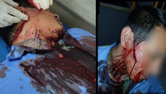 Chofer de la línea 57 fue agredido con arma blanca en Moreno por una discusión de boleto