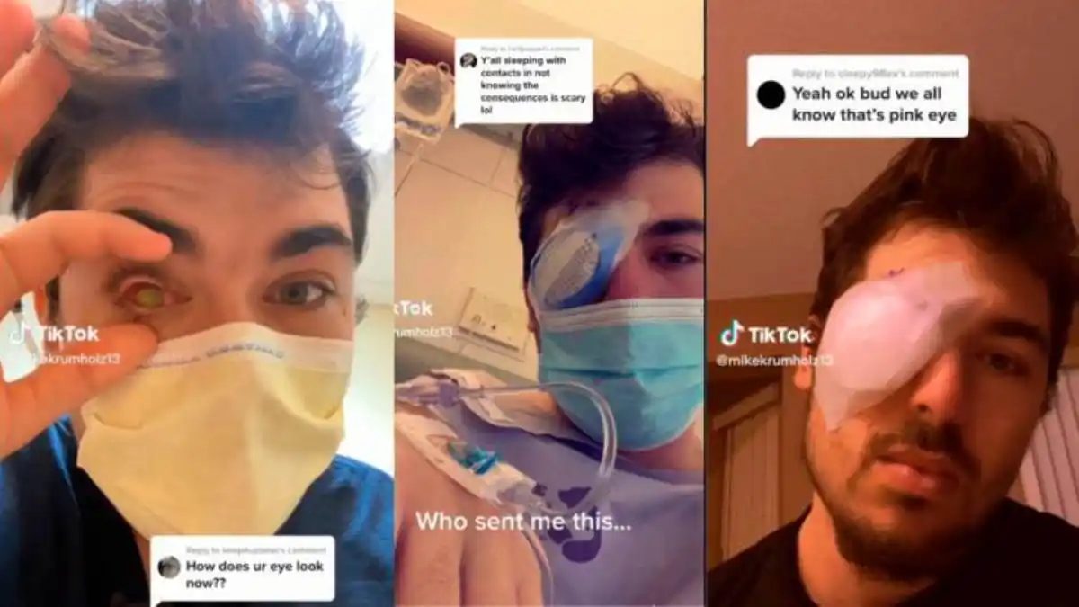 ¡CUÍDATE HASTA EN LA CAMA! Se durmió con sus lentes de contacto y quedó ciego por un parásito que le comió la córnea