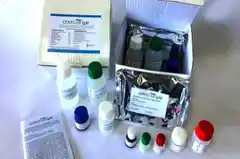 Coronavirus: Presentaron el test rápido para detectarlo