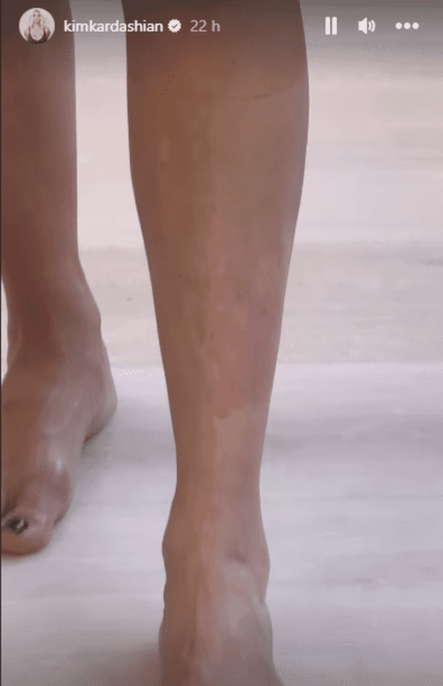 Kim Kardashian compartió su condición. Foto Instagram