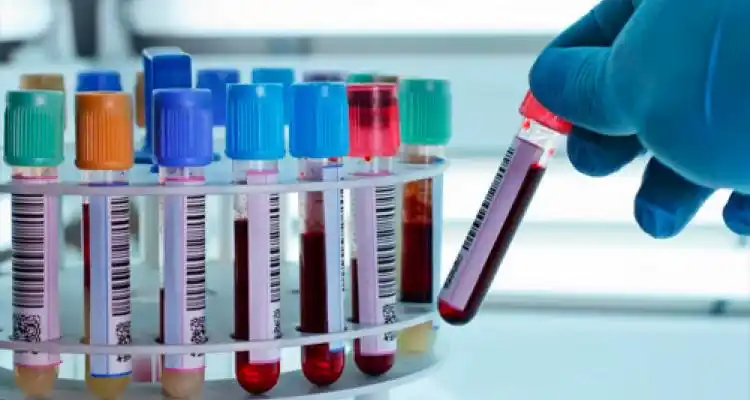 Suspendieron todos los exámenes bacteriológicos por falta de insumos en el Hospital y la oposición pidió un informe