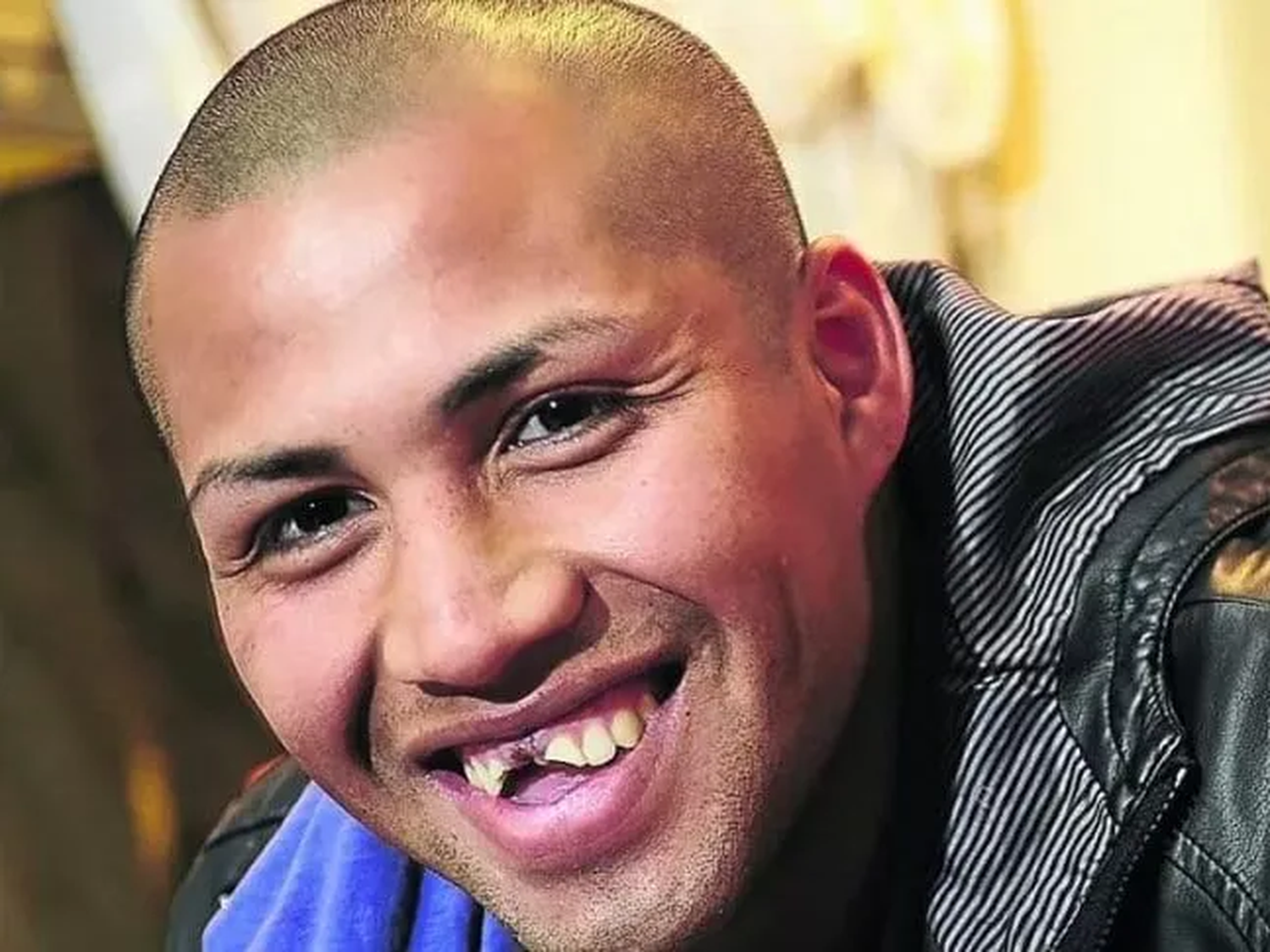 sin dientes