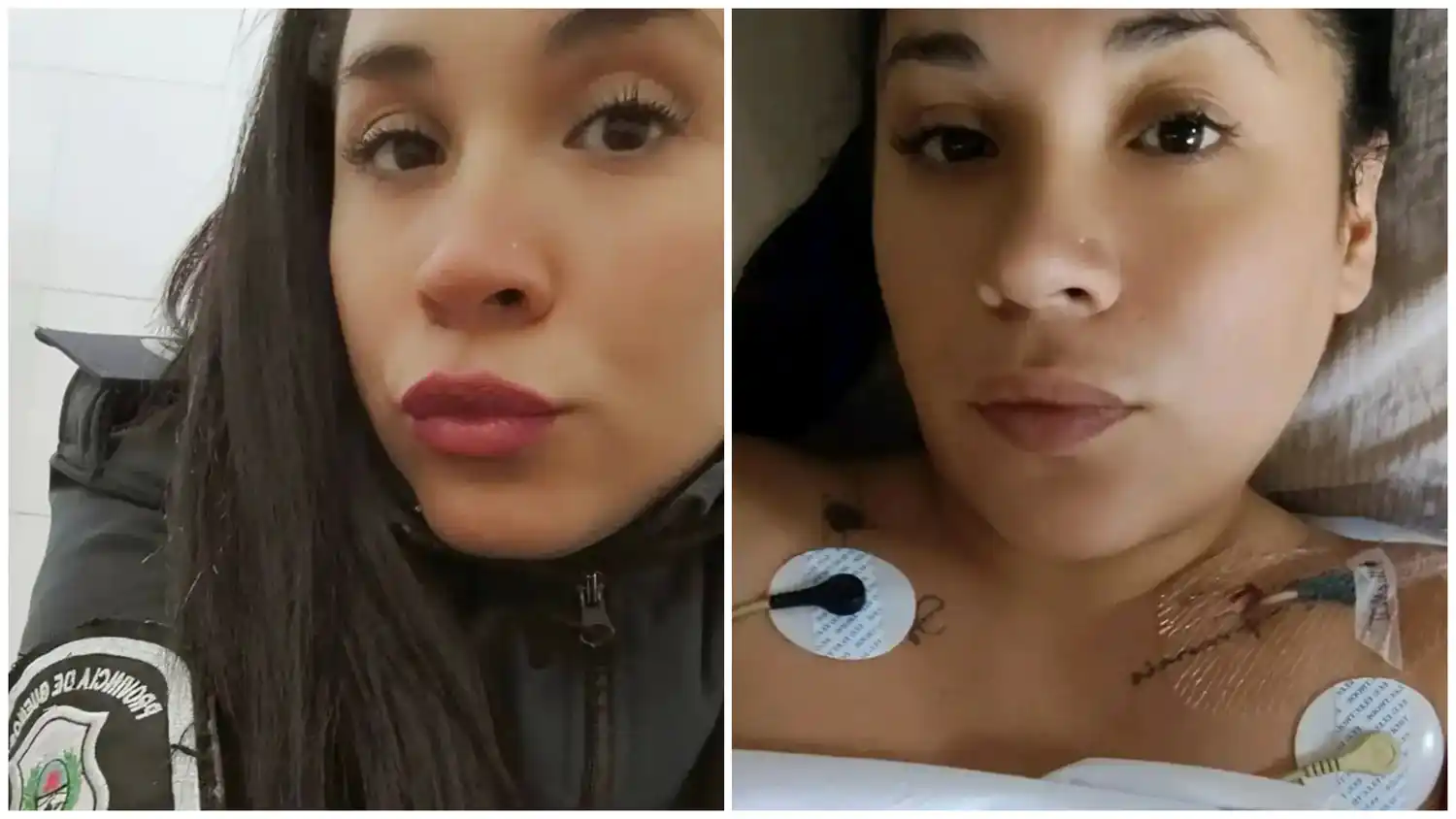 La joven recibió un disparo en la axila derecha que le perforó un pulmón.