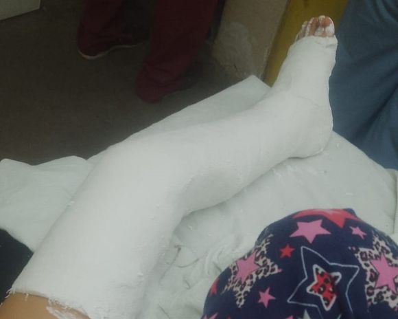Abril necesita una silla de ruedas
