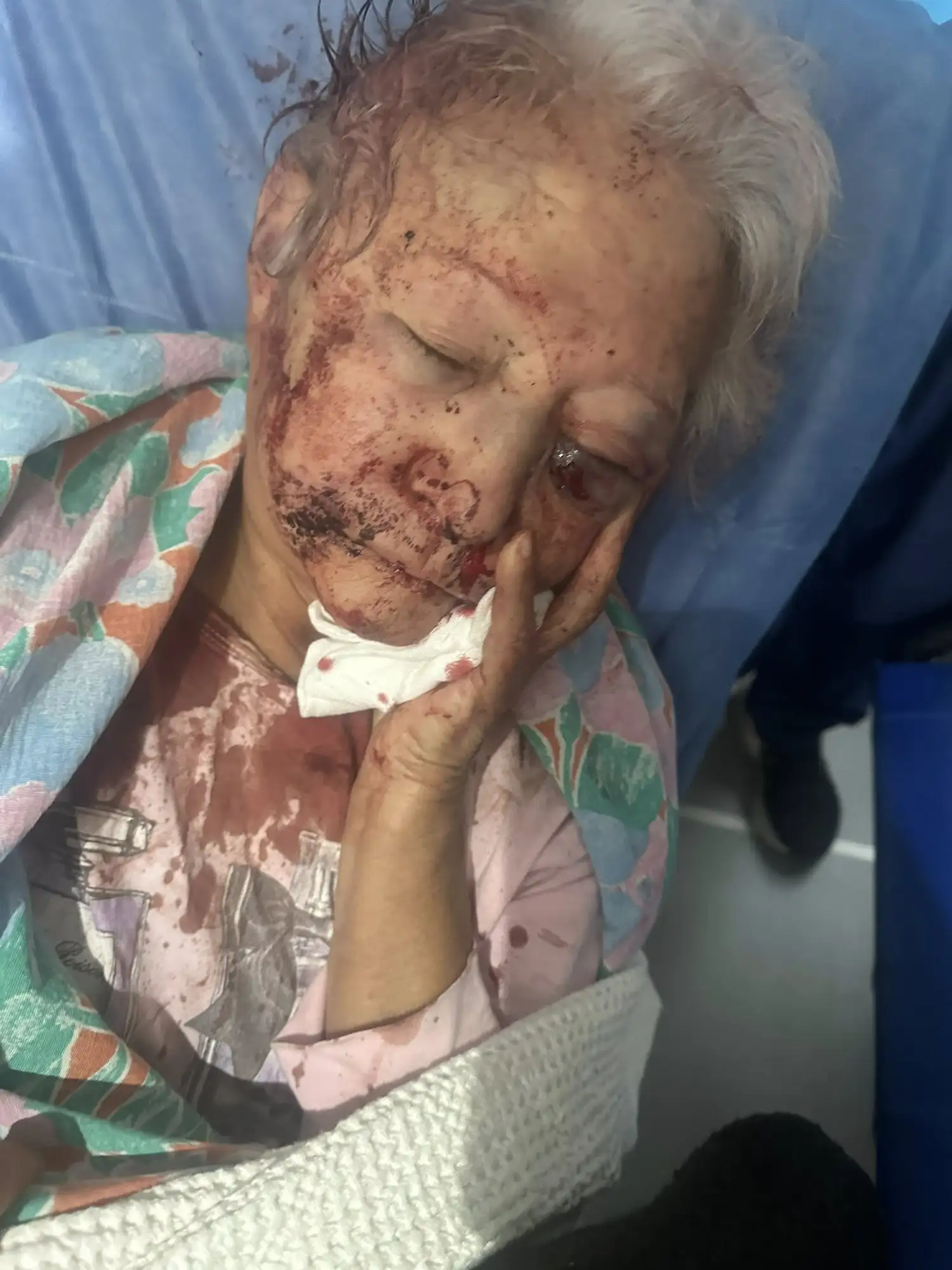 mujer asaltada golpeada