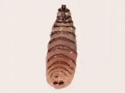 Una nena fue al hospital por un intenso dolor en el ojo y le encontraron gusanos en la cabeza