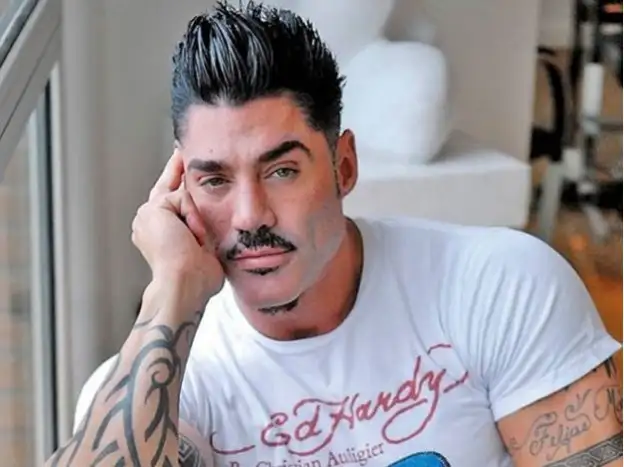 Ricardo Fort desmiente una supuesta amputación de su pierna