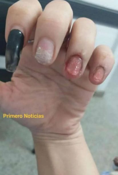 UÑAS