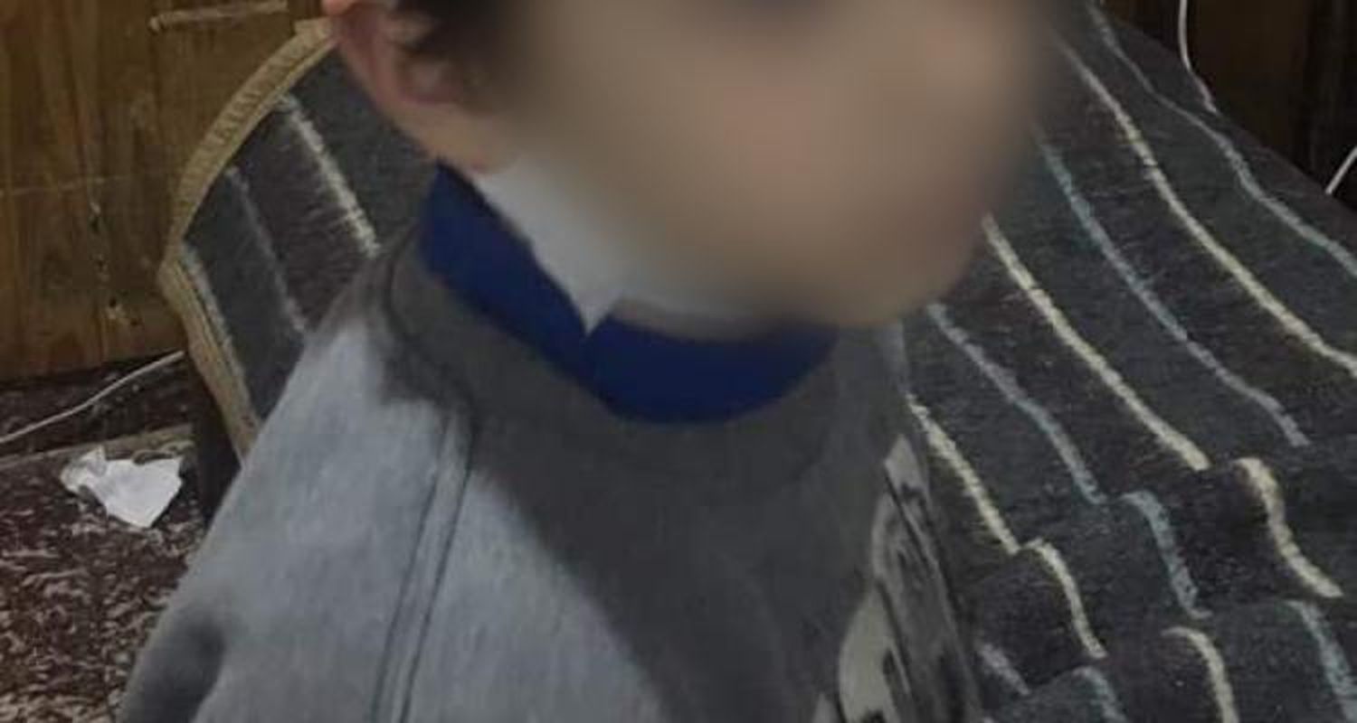 Un niño lastimó a otro de un piedrazo en la escuela 6