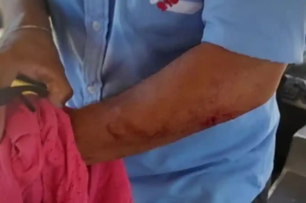 El chofer del colectivo herido