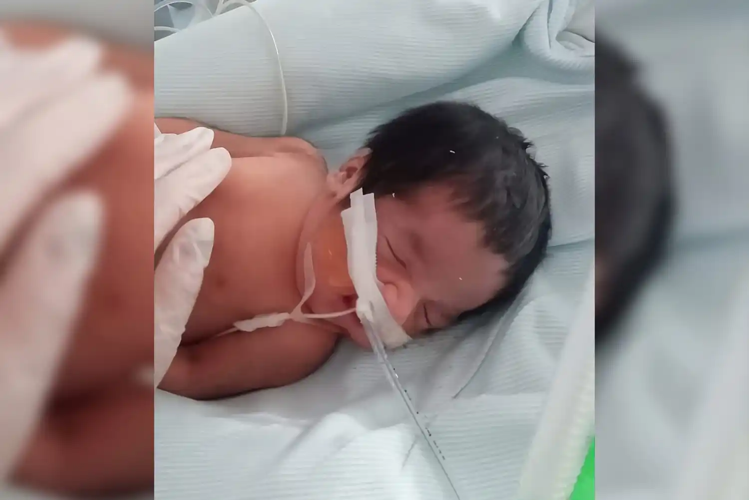 Leonel, el bebé prematuro internado en La Plata, respira por sus propios medios y “mejora de a poco”