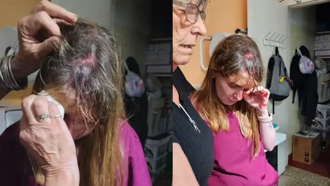El ataque ocurrió cuando la agresora llegó al lugar para reclamar tras la muerte de las crías de su coneja.