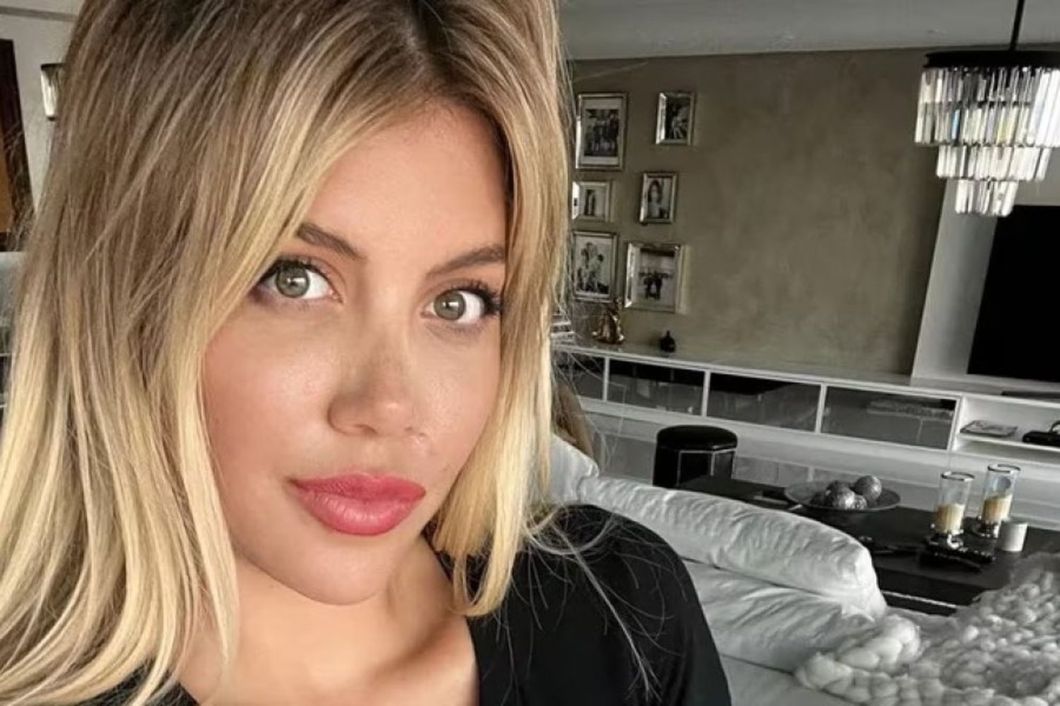 Wanda Nara: cómo es el duro tratamiento que tendría que enfrentar para superar su enfermedad